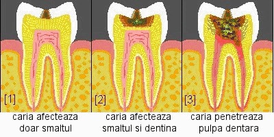 Pulpita acuta